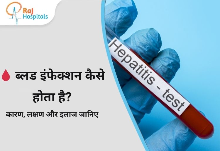 Typhoid Bar Bar Kyu Hota Hai - टाइफाइड बार-बार क्यों होता है? | RAJ Hospital Ranchi
