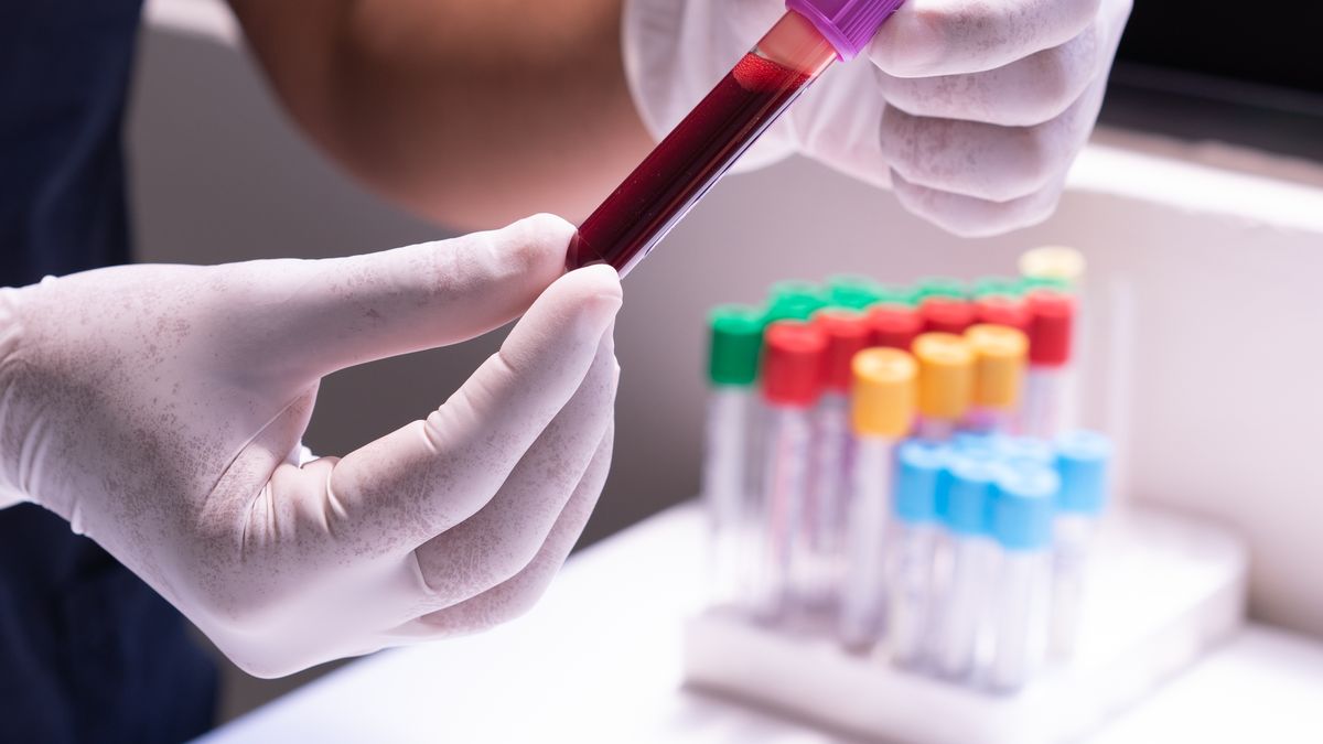 Lab technician holding a blood sample tube for hair fall investigations